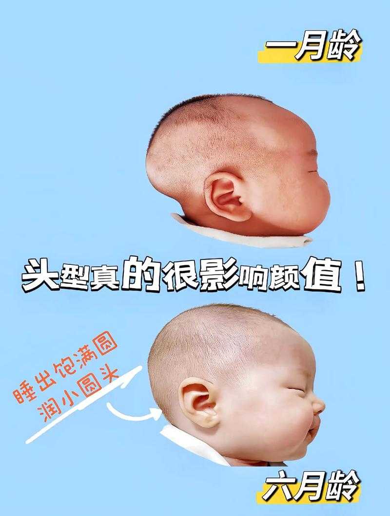 6个月宝宝双眼间距过宽正常吗？过来人的经验分享